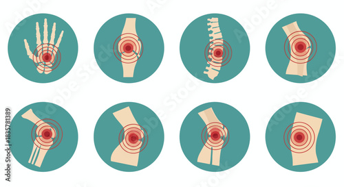 A vector illustration presents a set of human joints and bones, highlighting key areas with a focus on anatomical accuracy and medical representation against a simple, clean background.