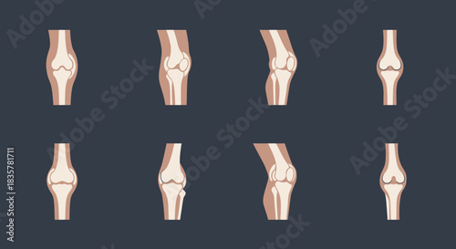 A detailed vector illustration showcases a set of human knee joints and bones, providing a clear anatomical representation suitable for medical and educational purposes against a dark background.