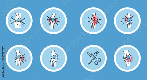 A detailed vector illustration showcases a set of human joints and bones, highlighting various conditions and medical concepts against a vibrant blue backdrop, perfect for educational or