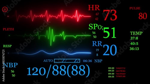 ICU medical monitor, irregular heartbeat. EKG monitor in ICU unit show The waves of blood pressure, blood oxygen saturation, ECG ,heart rate. New emergency 4k animation.