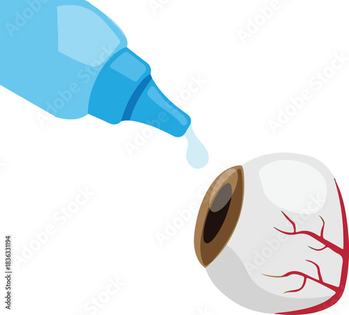 Illustration of an eye receiving a drop from a blue eye drop bottle, depicting eye care and treatment.