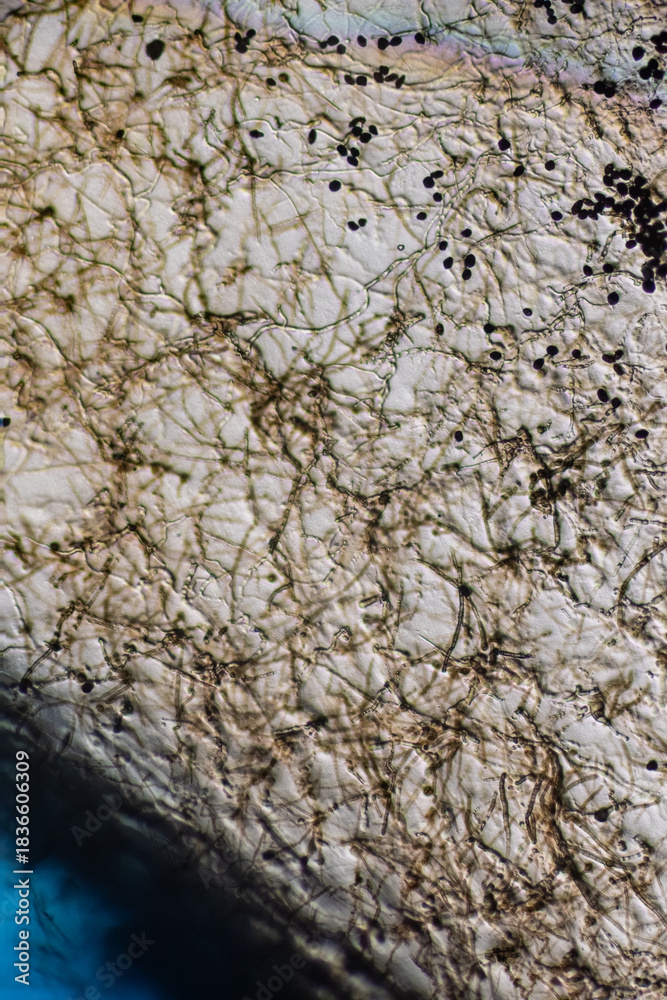 Fototapeta premium Microscopic View of Septate Dematiaceous Fungal Hyphae and Possible Chlamydospo