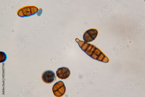 Dematiaceous Fungal Spores Exhibiting Transverse and Longitudinal Septation, Likely of the Genus Alterna
