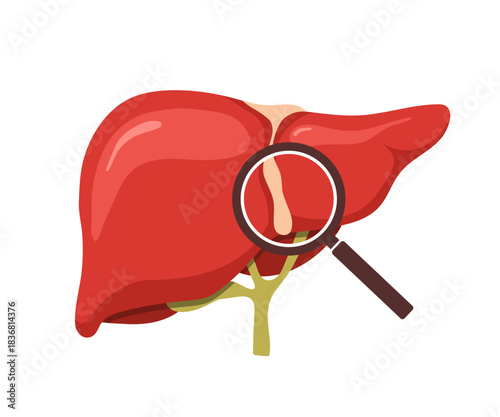Liver disease. Medical illustration of liver anatomy. Disease treatment for cancer or hepatitis. Vector design.
