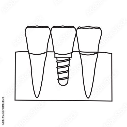 Dental Implant and Tooth Replacement line icon 