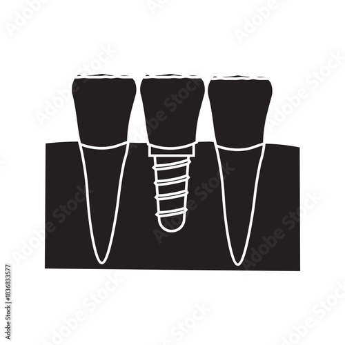 Dental Implant and Tooth Replacement glyph icon 