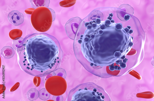 Tableau sur toile Acute myeloid leukemia (AML) cells in blood flow - semi closeup view 3d illustra