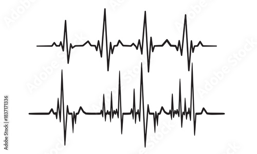 Two heartbeat ecg waveforms isolated on white background