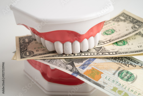 Treatment dental care cost, dental expense or fee, Euro banknote money with teeth model.