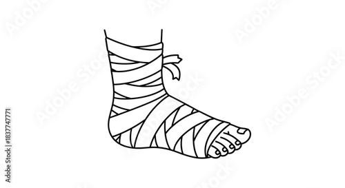 Line art illustration of a human foot and ankle wrapped in a bandage indicating an injury like a sprain or fracture.