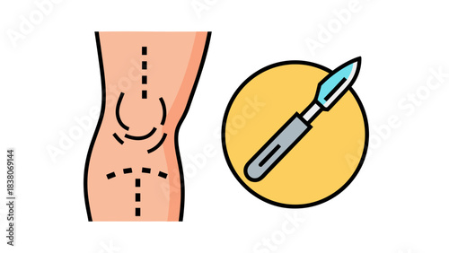 Surgical Procedure Depicting Knee Joint Reconstruction and Orthopedic Scalpel Illustration Healthcare Medical Concept