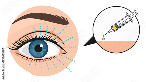 Close up of a blue eye with dotted lines indicating injection points for cosmetic enhancement and a magnified view of a syringe with yellow liquid dripping onto skin, representing aesthetic treatment