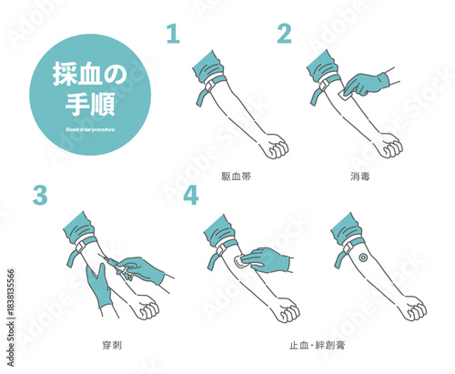 採血の手順イラスト（駆血帯・消毒・穿刺・止血）