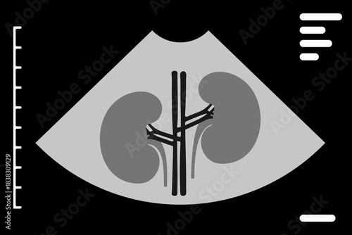 Ultrasound showing human kidneys and spine on monitor