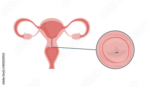 Medical illustration of the uterus and cervix