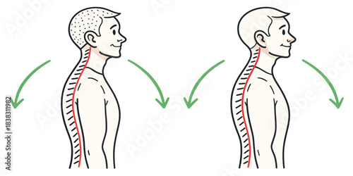 Posture Correction Comparison with Arrows human spine
