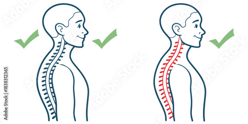 Spinal Alignment Comparison with Checkmarks spine posture