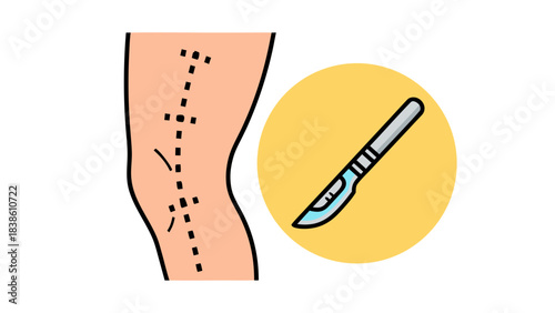 Medical Illustration of a Skin Incision Marked with Dotted Lines on a Leg Alongside a Surgical Scalpel Icon Representing a Medical Procedure or Operation