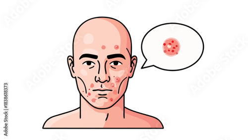 Pixel Art Portrait Of A Bald Man With Red Pimples On His Face And A Thought Bubble Showing A Close Up Of Skin Irritation Medical Illustration On Black Background