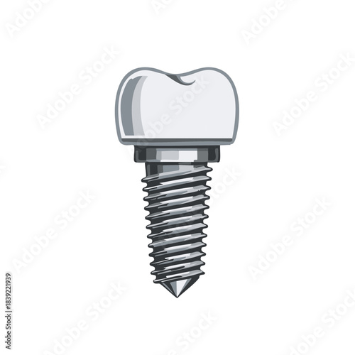 Dental Implant Illustration Graphic for Medical Dentistry Surgical Procedures