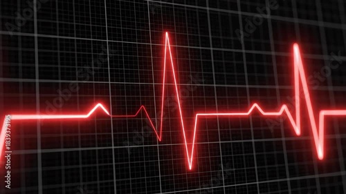 Animated Red Heartbeat Graph Displaying on a Dark Monitor Screen