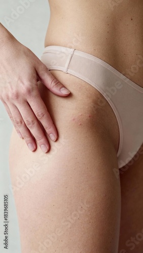 Woman ready for laser hair removal treatment on bikini line