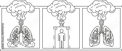 Air pollution impact on human lungs illustration showing toxic smog inhalation, respiratory health damage, environmental hazard concept vector diagram medical