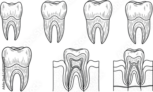 Tooth anatomy diagram set showing enamel, dentin, pulp, and root structure