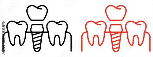 Tooth Recovery Procedure Thin Line Vector. Contour symbol representing Dental Surgery, Oral Health, and Restorative Dentistry. Vector isolated outline drawing with an editable stroke.
