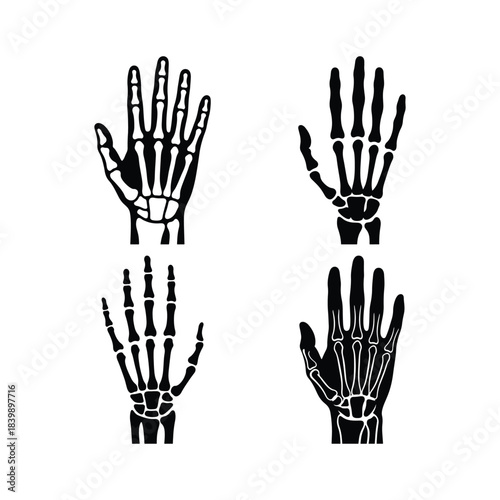 Hand x-ray silhouette set medical imaging