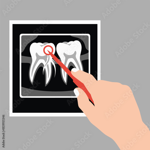 Dental X ray Inspection