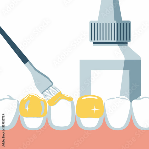 Dental bonding process for gold crown application on healthy teeth