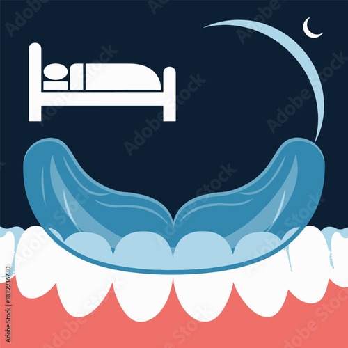Illustration of a dental night guard protecting teeth during sleep at night