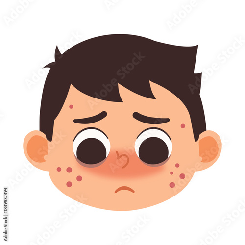Illustration of Boy with Acne and Sad Expression