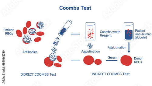 Direct and Indirect Coombs Test Vector Diagram