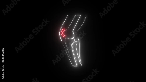 a neon-style illustration of a human knee joint, highlighting the C-shaped meniscus in red.