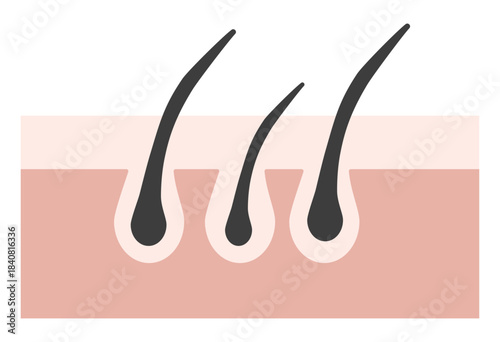 Hair Follicle and Pore Cross-Section Illustration Showing Skin Structure