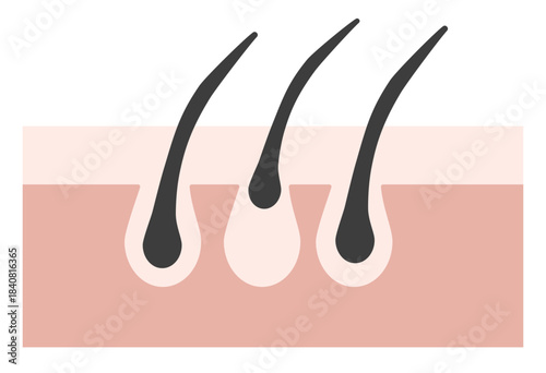Hair Follicle and Pore Cross-Section Illustration Showing Skin Structure