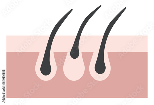 Hair Follicle and Pore Cross-Section Illustration Showing Skin Structure