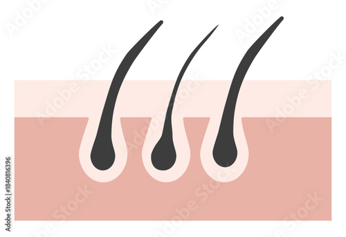 Hair Follicle and Pore Cross-Section Illustration Showing Skin Structure