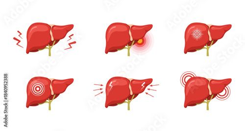 Liver pain. Medical illustration of human liver anatomy. Disease treatment and healthcare icons. Vector design.
