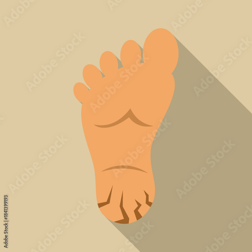 Foot sole showing cracked heel and dry skin, illustrating dermatology issue