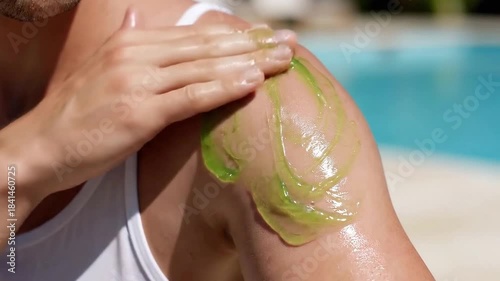Applying Cool Aloe Vera Gel To Sunburned Shoulder Near Bright Blue Swimming Pool On A Sunny Day