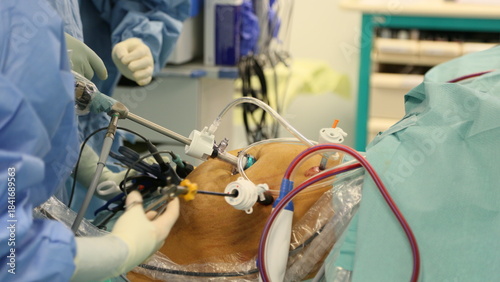 Intervention chirurgicale laparoscopique en bloc opératoire