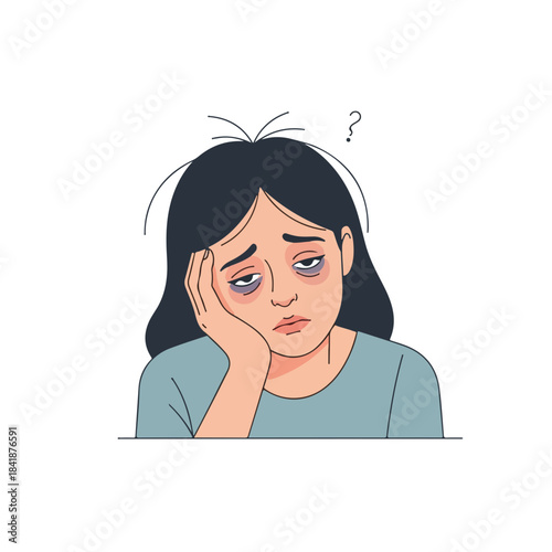 Tired woman showing dark circles under eyes, messy hair, head on hand, confused expression. This exhausted female depicts chronic fatigue, burnout, and sleep deprivation.