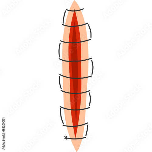 Suture Illustration