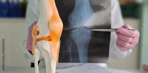 Tableau sur toile Traumatologist examining x-ray and showing problem on anatomical model of knee closeup