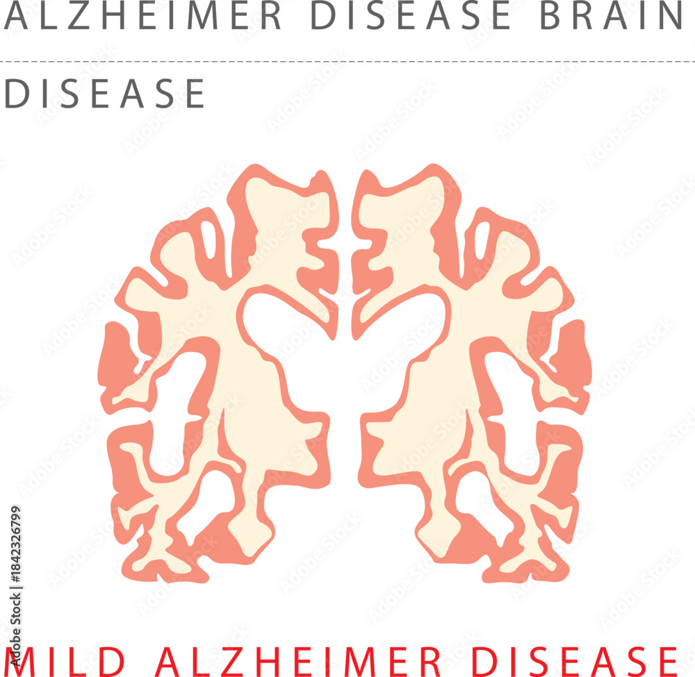 Naklejka premium ALZHEIMER