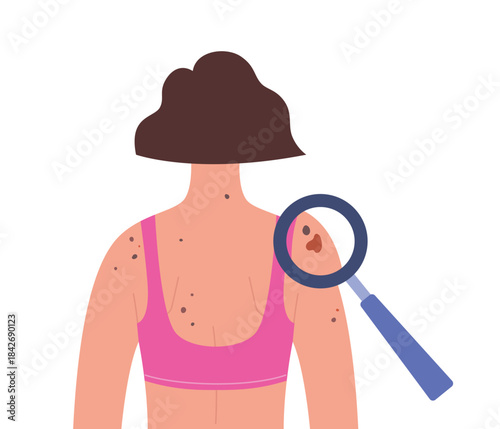 Dermatology screening. Dermatoscopy examination. Skin cancer diagnosis of a woman. Healthcare vector illustration