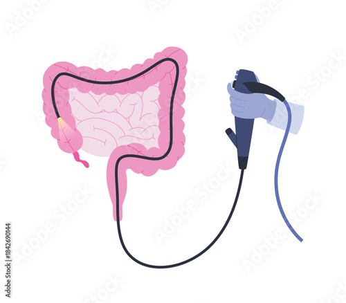 Colonoscopy procedure. Examination and treatment of the large intestine. Flat vector illustration of an invasive medical procedure